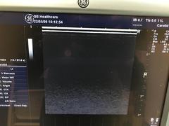 超音波診断装置（カラードプラ）｜LOGIQ P5｜GEヘルスケアの写真18枚目