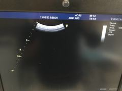 超音波診断装置（カラードプラ）｜Vivid S6｜GEヘルスケアの写真18枚目