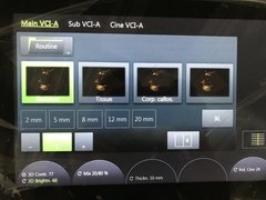 4D超音波診断装置（カラードプラ）｜Voluson E10｜GEヘルスケアの写真18枚目