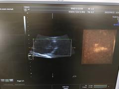 Ultrasound system(Color)｜Voluson E6｜GE Healthcare photo18