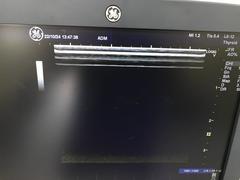 超音波診断装置（カラードプラ）｜LOGIQ V5｜GEヘルスケアの写真18枚目