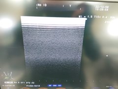超音波診断装置｜F37｜日立製作所の写真18枚目