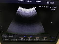 Ultrasound system｜F37｜Hitachi photo18