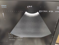 Ultrasound system｜ARIETTA 60｜Hitachi photo18