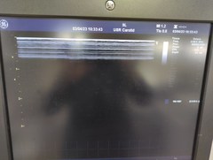 超音波診断装置(カラードプラ)ＬＣＤ｜Vivid E9 with XDclear｜GEヘルスケアの写真18枚目