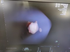 4D超音波診断装置（カラードプラ）｜Voluson E10｜GEヘルスケアの写真18枚目