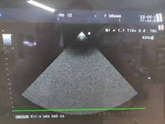 超音波診断装置（カラー）｜Prosound α6｜日立製作所の写真18枚目