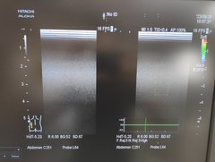 超音波診断装置｜ARIETTA S70｜日立製作所の写真18枚目