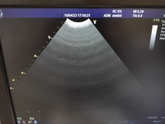 Ultrasound system(Color)｜Vivid S6｜GE Healthcare photo18