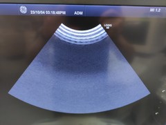 超音波診断装置｜LOGIQ S8 XDclear｜GEヘルスケアの写真16枚目