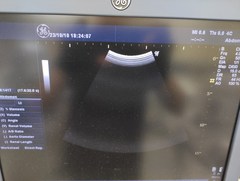 超音波診断装置（カラードプラ）｜LOGIQ P6｜GEヘルスケアの写真18枚目
