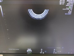 Ultrasound system(Color)｜Voluson E10｜GE Healthcare photo18