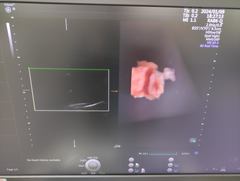 4D超音波診断装置（カラードプラ）｜Voluson E8｜GEヘルスケアの写真18枚目