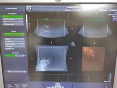 Ultrasound system(Color)｜Voluson S8｜GE Healthcare photo15