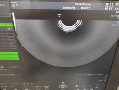 Ultrasound system(Color)｜Voluson P8｜GE Healthcare photo18