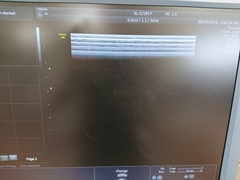 4D超音波診断装置（カラードプラ）｜Voluson E6｜GEヘルスケアの写真18枚目