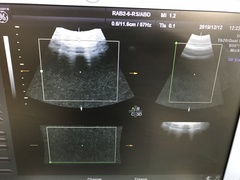 ４Ｄ超音波診断装置（カラードプラ）｜Voluson e｜GEヘルスケアの写真19枚目