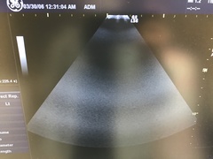 超音波診断装置｜LOGIQ S6(LCD)｜GEヘルスケアの写真18枚目