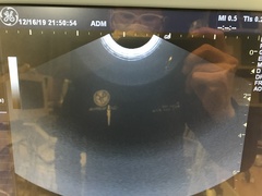 超音波診断装置（カラードプラ）の写真4枚目