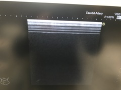 Ultrasound system(Color)｜HI VISION Avius｜Hitachi photo16