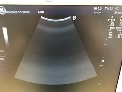 Ultrasound system(Color)｜LOGIQ 7｜GE Healthcare photo19