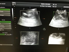 Ultrasound system(Color)｜Voluson S8｜GE Healthcare photo19
