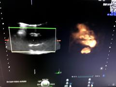 Ultrasound system(Color)｜Voluson E8｜GE Healthcare photo11