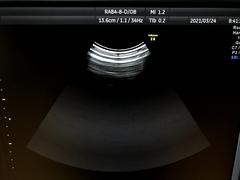 Ultrasound system(Color)｜Voluson E8｜GE Healthcare photo14
