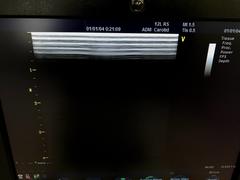 Ultrasound system(Color)｜Vivid S5｜GE Healthcare photo2