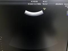 Ultrasound system(Color)｜Voluson S6｜GE Healthcare photo14