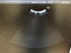 Ultrasound system(Color)｜Voluson E6｜GE Healthcare photo13