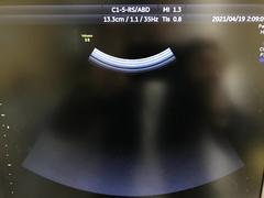 Ultrasound system(Color)｜Voluson S8｜GE Healthcare photo14