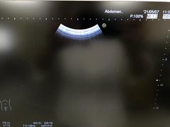 Ultrasound system(Color)｜HI VISION Avius｜Hitachi photo14