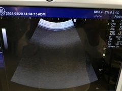 Ultrasound system(Color)｜LOGIQ iM｜GE Healthcare photo14