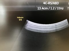 Ultrasound system(Color)｜Voluson S6｜GE Healthcare photo15