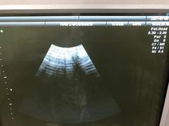 Ultrasound system(Color)｜Voluson 730 Expert｜GE Healthcare photo15