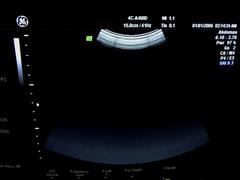 Ultrasound system(Color)｜VOLUSON 730PRO｜GE Healthcare photo19