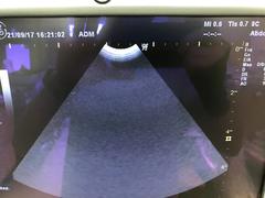 Ultrasound system(Color)｜LOGIQ P5｜GE Healthcare photo2