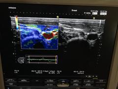 Ultrasound system(Color)｜HI VISION Avius｜Hitachi photo16