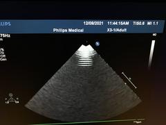 Ultrasound system｜iE33｜Philips photo19