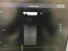 超音波診断装置（カラードプラ）｜SSA-660A Xario(LCD)｜キヤノンメディカルシステムズの写真19枚目