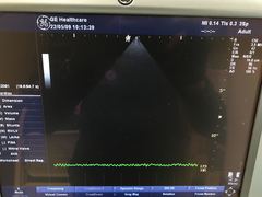 超音波診断装置（カラードプラ）｜LOGIQ P5｜GEヘルスケアの写真19枚目