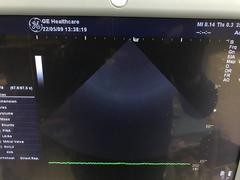 超音波診断装置（カラードプラ）｜LOGIQ P5｜GEヘルスケアの写真19枚目