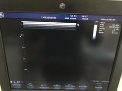 超音波診断装置（カラードプラ）｜Vivid S6｜GEヘルスケアの写真19枚目