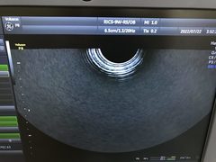 4D超音波診断装置（カラードプラ）｜Voluson P8｜GEヘルスケアの写真19枚目