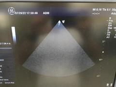 超音波診断装置（カラードプラ）｜LOGIQ P6｜GEヘルスケアの写真19枚目