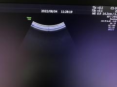 4D超音波診断装置（カラードプラ）｜Voluson E10｜GEヘルスケアの写真19枚目