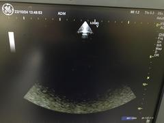 超音波診断装置（カラードプラ）｜LOGIQ V5｜GEヘルスケアの写真19枚目