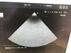 超音波診断装置（カラー）｜Prosound α6｜日立製作所の写真19枚目