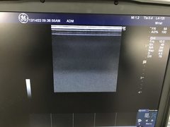 超音波診断装置｜LOGIQ e Premium｜GEヘルスケアの写真19枚目
